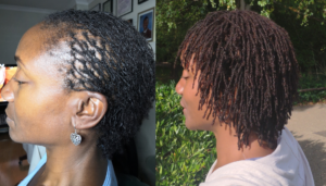 Sisterlocks day 0 to month 20