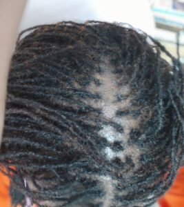 I stopped retightening my Sisterlocks