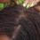 What my crown looks like after 6 months of no retightenings